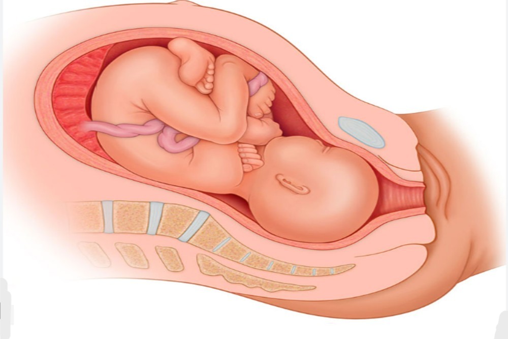 Abnormal baby - Rahat Hospital
