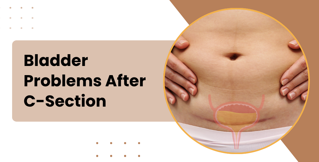 Bladder Problems After C-Section
