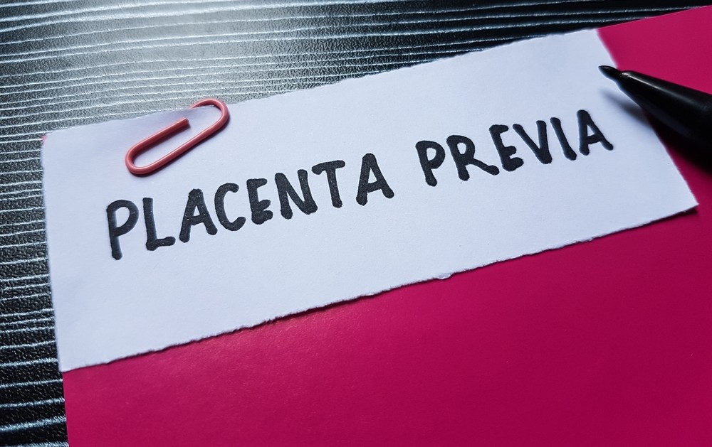 Placenta previa - Rahat Hospital Placenta previa