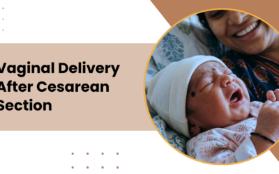 Vaginal Delivery After Cesarean (VBAC): Safety & Planning