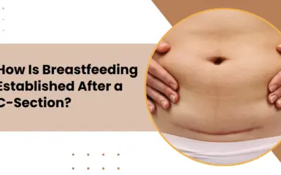 How Is Breastfeeding Established After a C-Section?