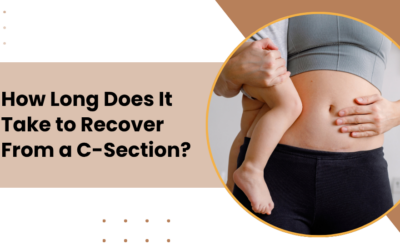 How Long Does It Take to Recover From a C-Section?
